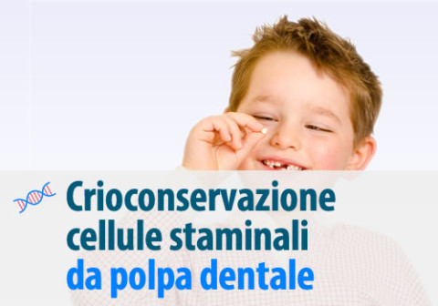 Crioconservazione cellule staminali da polpa dentale