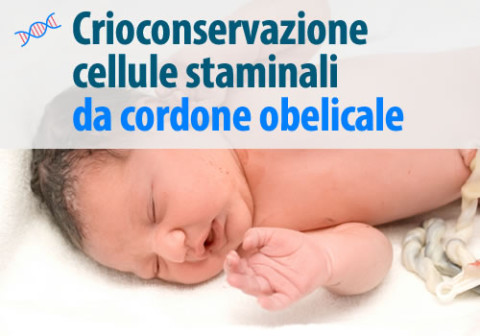 Crioconservazione cellule staminali da cordone ombelicale